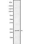 ARL4 Antibody in Western Blot (WB)