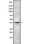GnRHR Antibody in Western Blot (WB)