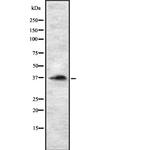 RASSF2 Polyclonal Antibody