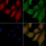 NPC1L1 Polyclonal Antibody