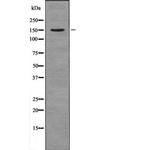 NPC1L1 Antibody in Western Blot (WB)