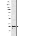 Adrenomedullin Polyclonal Antibody