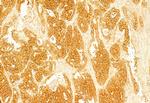 Ameloblastin Antibody in Immunohistochemistry (Paraffin) (IHC (P))
