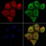 ATP5J2 Polyclonal Antibody