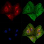 ATP7A Polyclonal Antibody