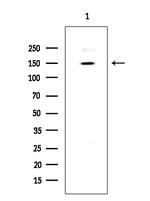 BRCAA1 Polyclonal Antibody