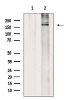 SMARCA2 Polyclonal Antibody