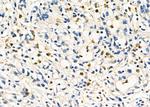 Cathepsin H Polyclonal Antibody