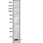 CCK Antibody in Western Blot (WB)
