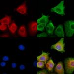 alpha-Defensin 3 Polyclonal Antibody