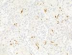 DIO3 Polyclonal Antibody