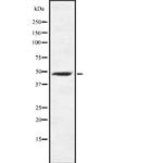 DP2 Polyclonal Antibody