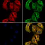 GUCY1B2 Polyclonal Antibody