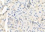 HIC2 Polyclonal Antibody