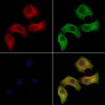 IL20RA Polyclonal Antibody