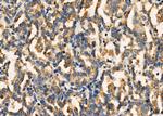 INHBC Polyclonal Antibody