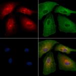 KCNMB4 Antibody in Immunocytochemistry (ICC/IF)