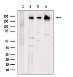 SCN2A Polyclonal Antibody