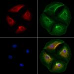 SCN8A Polyclonal Antibody