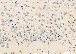 NMDAR2C Polyclonal Antibody