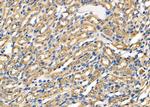 OCRL Polyclonal Antibody