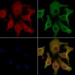 PANK2 Polyclonal Antibody