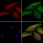 SGCB Polyclonal Antibody