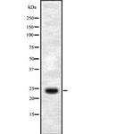 SERTAD1 Polyclonal Antibody