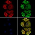 ST3GAL3 Polyclonal Antibody