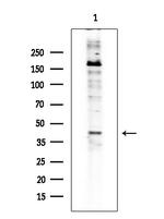 ST3GAL3 Antibody in Western Blot (WB)