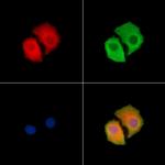Synphilin 1 Polyclonal Antibody