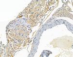 Synphilin 1 Antibody in Immunohistochemistry (Paraffin) (IHC (P))
