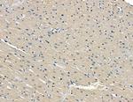 Synphilin 1 Antibody in Immunohistochemistry (Paraffin) (IHC (P))