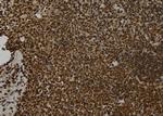 Synphilin 1 Antibody in Immunohistochemistry (Paraffin) (IHC (P))