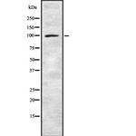Synphilin 1 Antibody in Western Blot (WB)