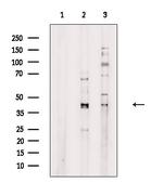 KCNK3 Polyclonal Antibody