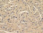 TENC1 Antibody in Immunohistochemistry (Paraffin) (IHC (P))