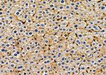 PRSS3 Antibody in Immunohistochemistry (Paraffin) (IHC (P))