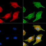 VAMP1/VAMP2/VAMP3 Polyclonal Antibody