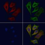 ATP6V0D1 Polyclonal Antibody