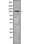 alpha Actinin 1/2/3/4 Polyclonal Antibody
