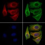 AWAT1 Polyclonal Antibody