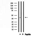 AWAT1 Antibody in Western Blot (WB)