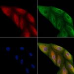 CYB561D2 Polyclonal Antibody