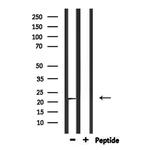 CYB561D2 Antibody in Western Blot (WB)
