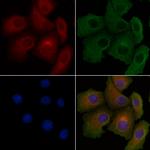 CARD10 Polyclonal Antibody