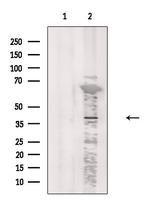 CCRL2 Antibody in Western Blot (WB)