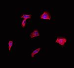 CD2BP2 Polyclonal Antibody