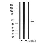 CD2BP2 Antibody in Western Blot (WB)