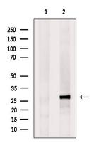 eIF4E3 Polyclonal Antibody